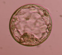 Expanded blastocyst 4AΒ